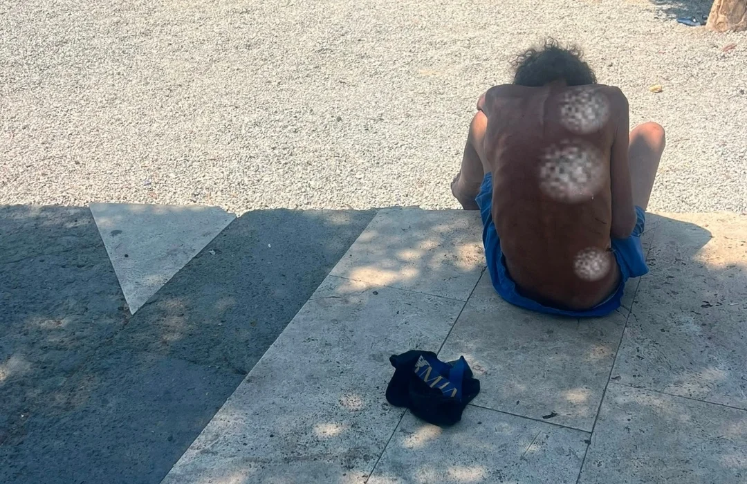 Kumbahçe sahilinde çıplak dolaşan kişi hastaneye kaldırıldı